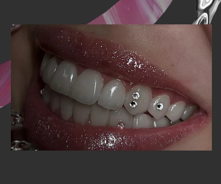 Une photo de la section Stands : un sourire aux dents ornées de strass.